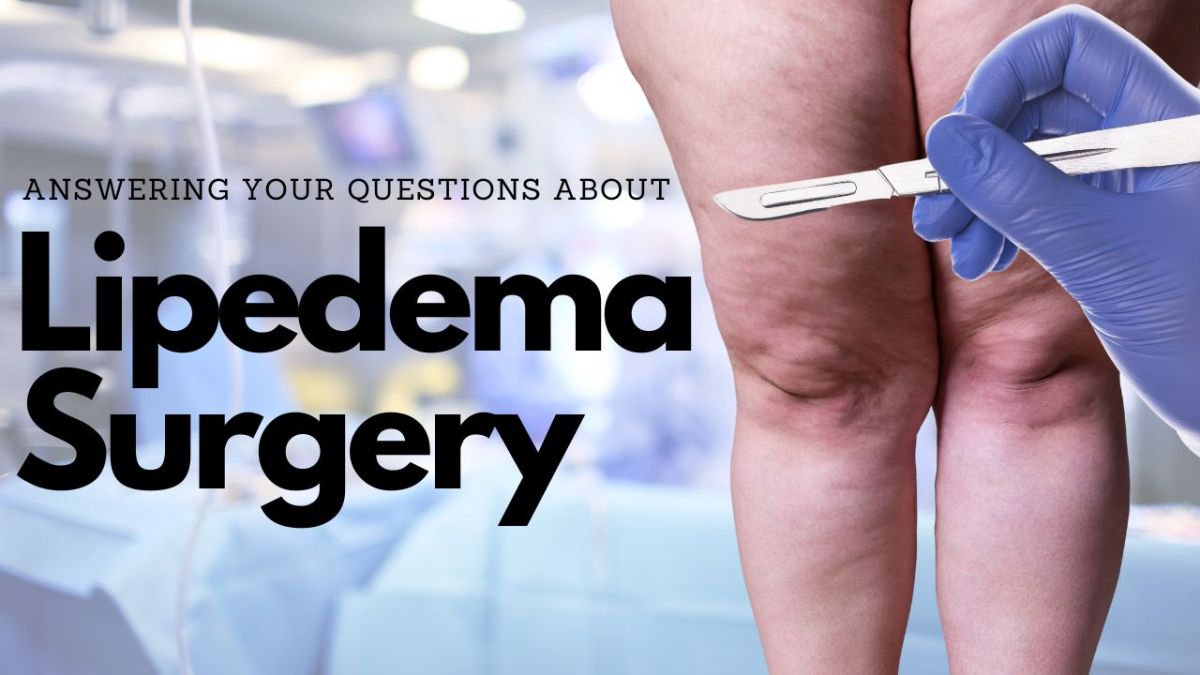 lipedema compression pump – Sturdy Woman